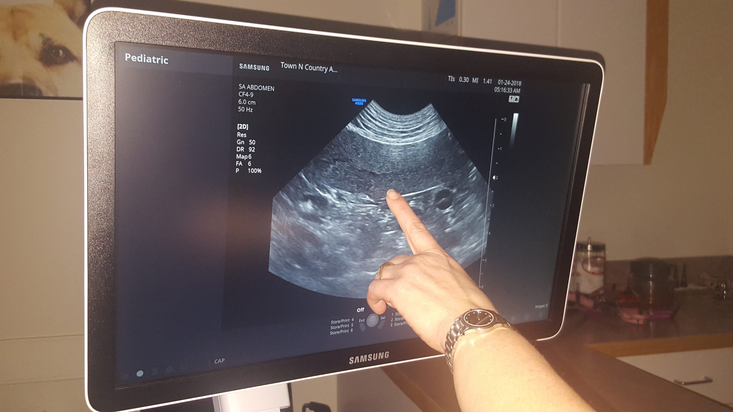 clear diagnostic