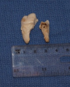 extracted dog teeth extracted dog teeth